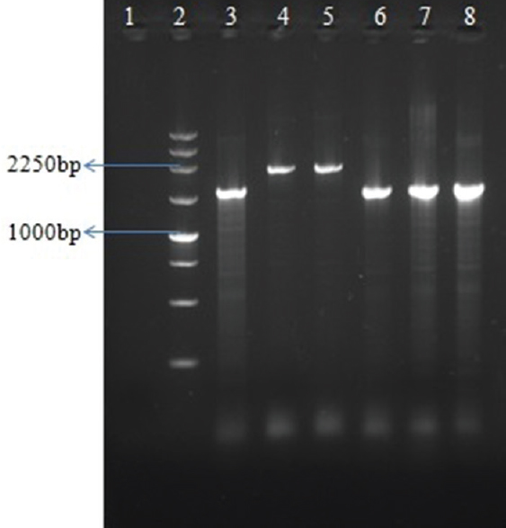 Polymerase chain reaction for detection of gene cassettes (5’-CS with 3’-CS). Lane 1, negative control; lane 2, 250 bp Ladder; lane 3-8, PA27, PA30, PA42, PA44, PAE120, PAE131.